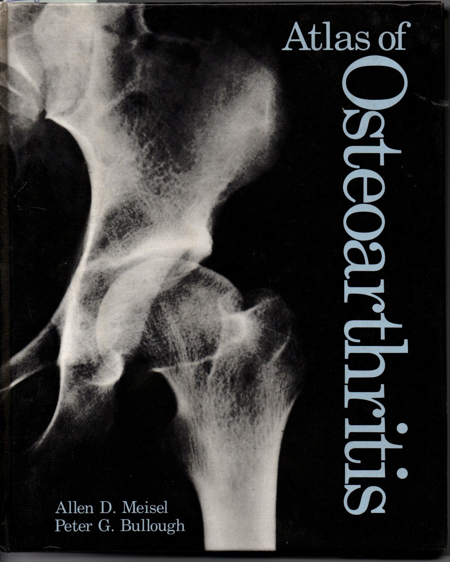ATLAS OF OSTEOARTHRITIS