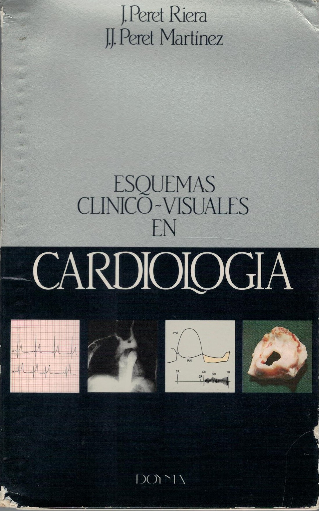 ESQUEMAS CLINICO - VISUALES EN CARDIOLOGIA.
