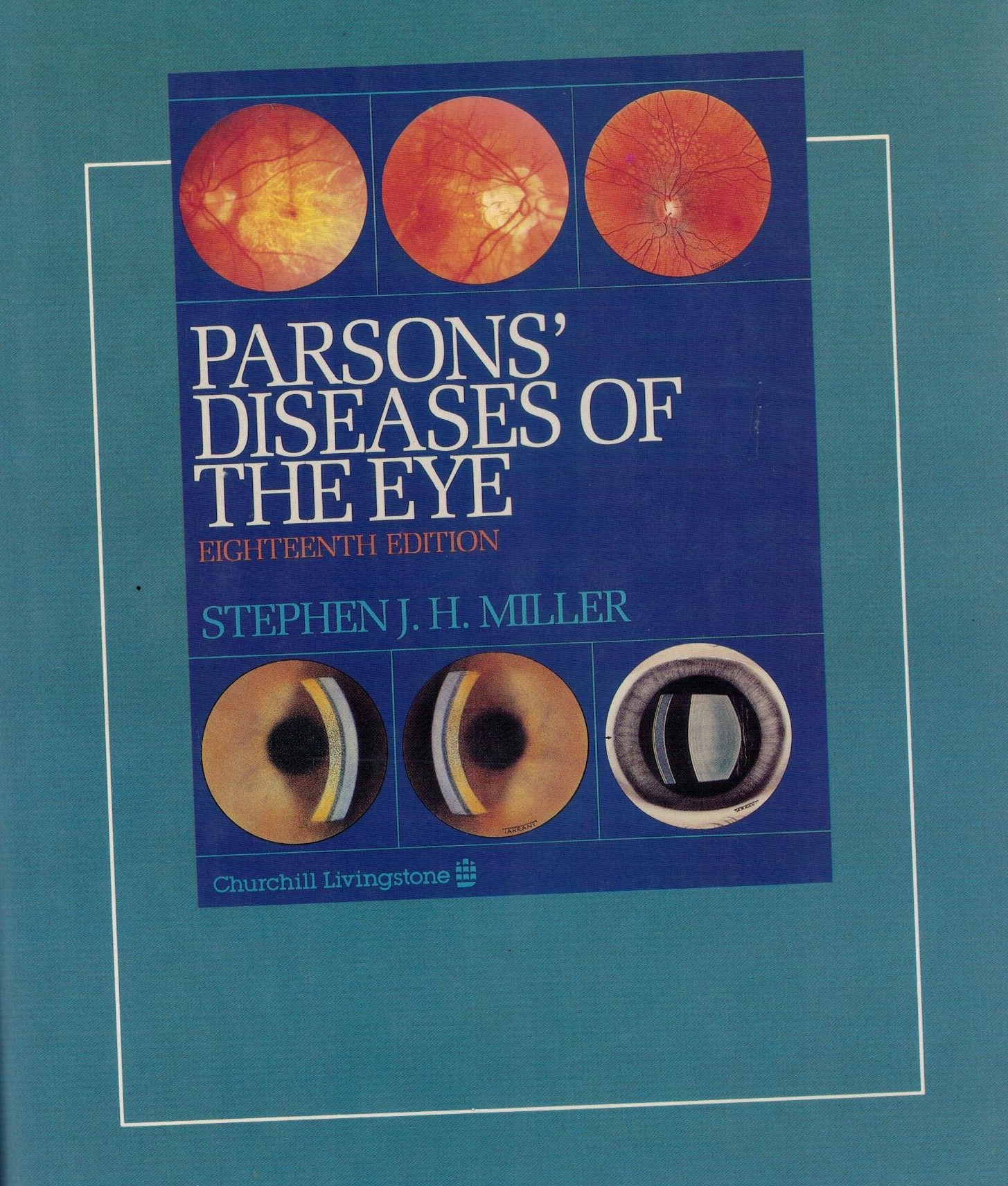PARSONS DISEASES OF THE EYE
