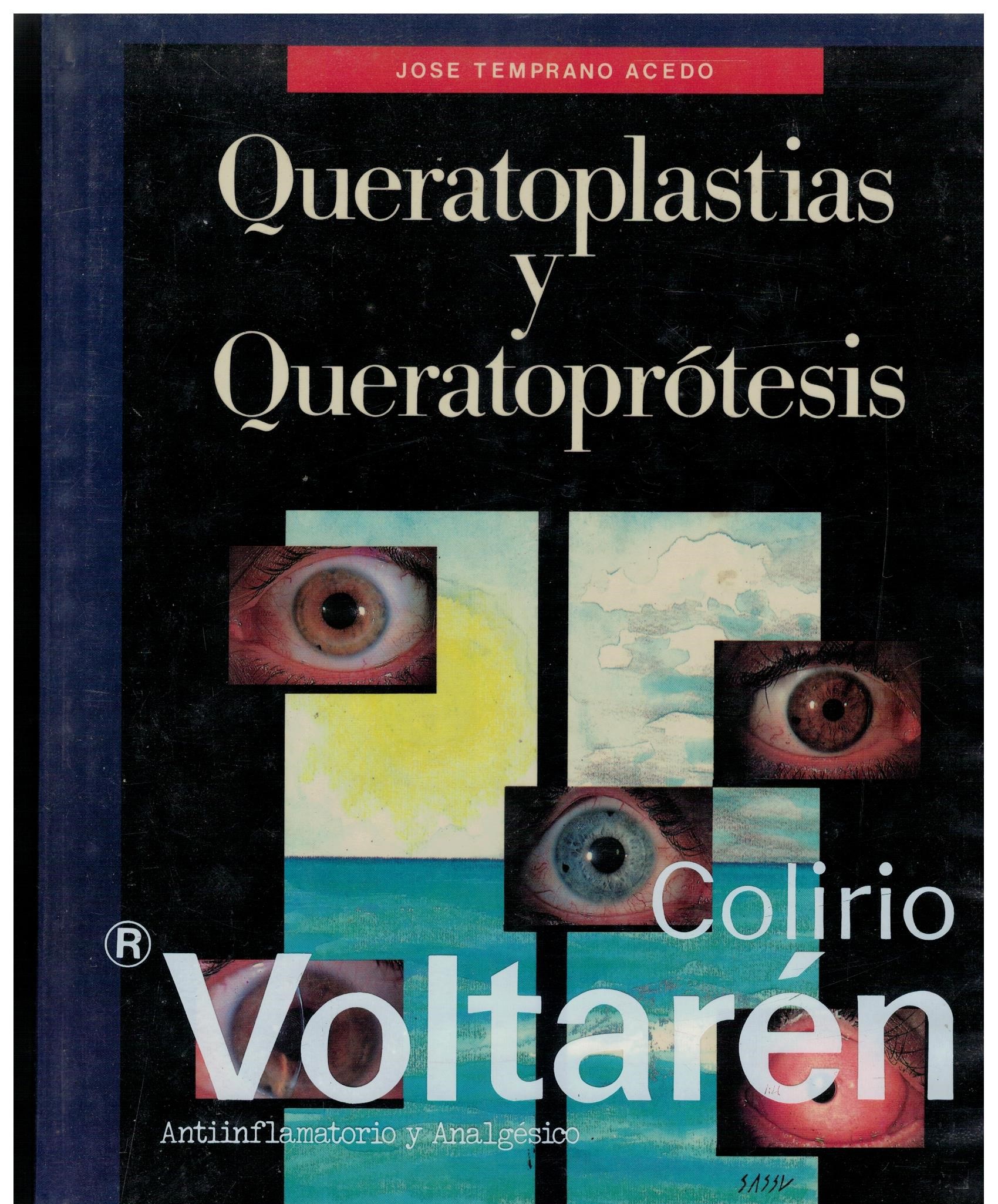 QUERATOPLASTIAS Y QUERATOPROTESIS