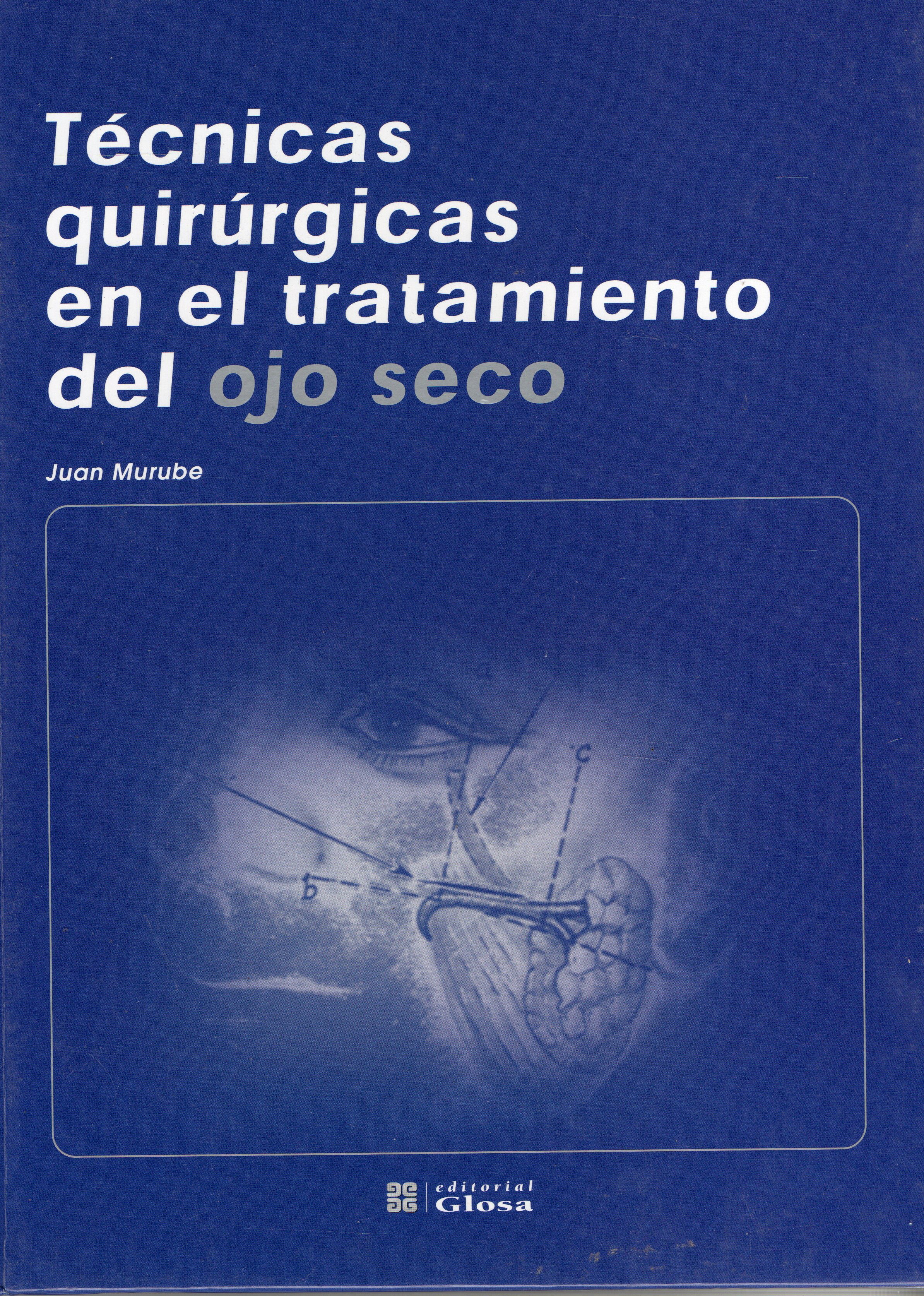 TECNICAS QUIRURGICAS EN EL TRATAMIENTO DEL OJO SECO