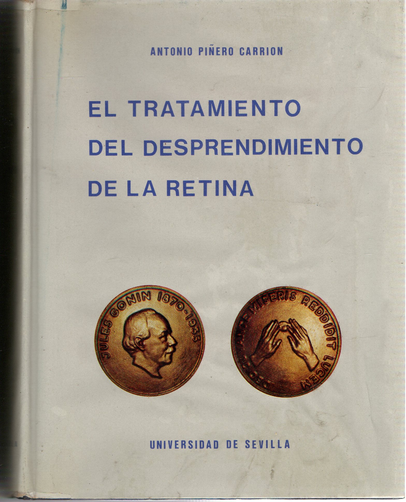 EL TRATAMIENTO DEL DESPRENDIMIENTO DE LA RETINA