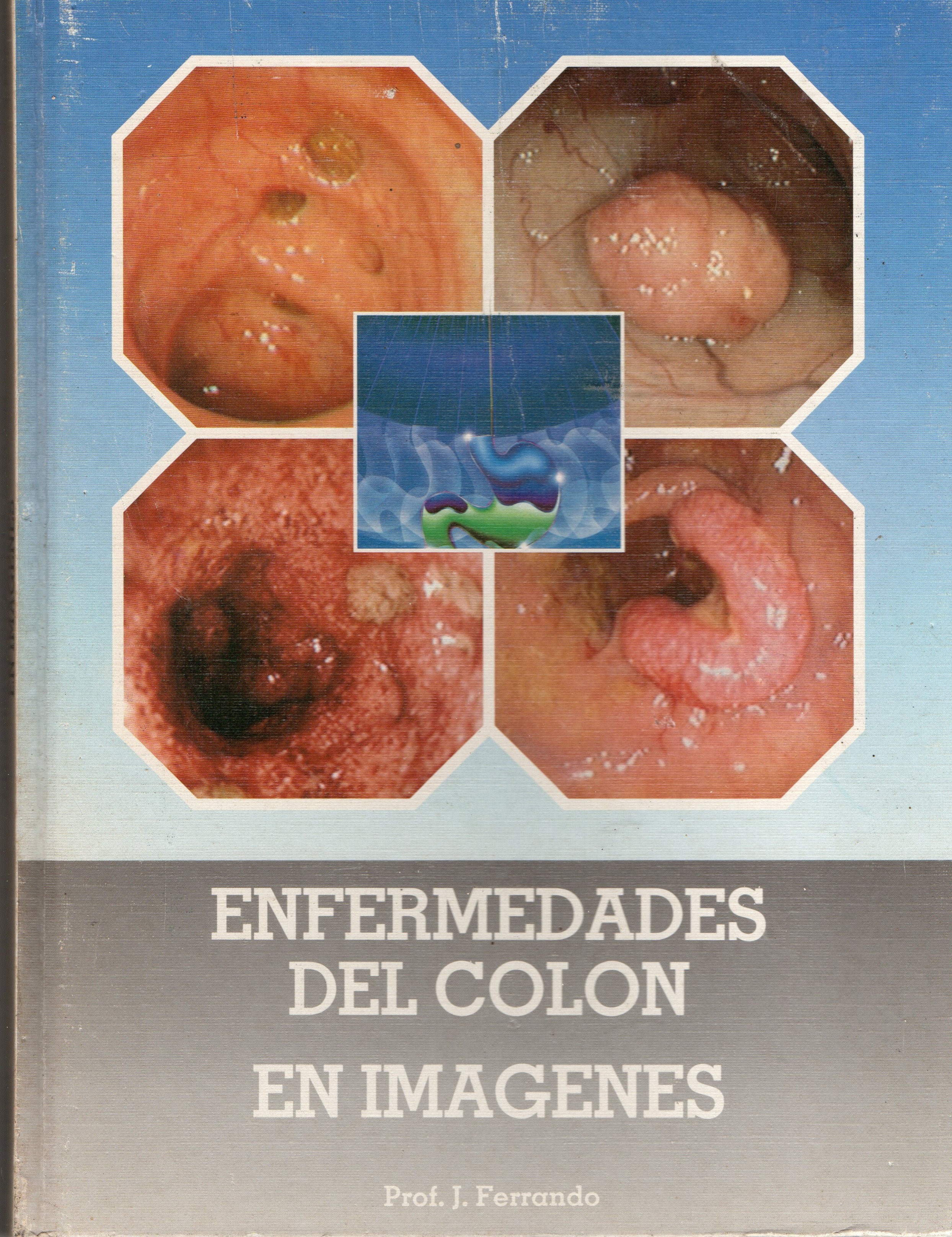 ENFERMEDADES DEL COLON EN IMÁGENES