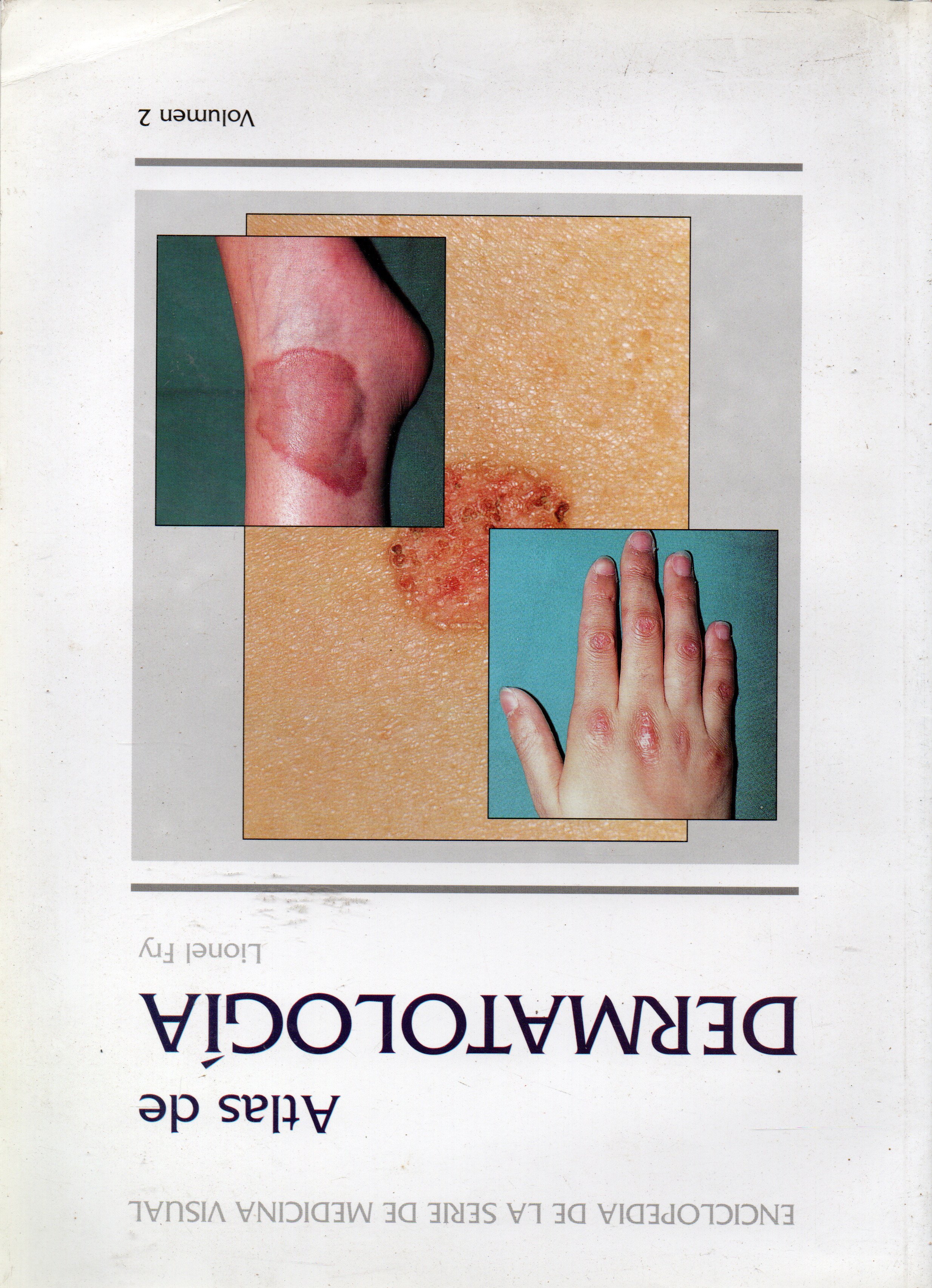 ATLAS DE DERMATOLOGIA VOL. 2