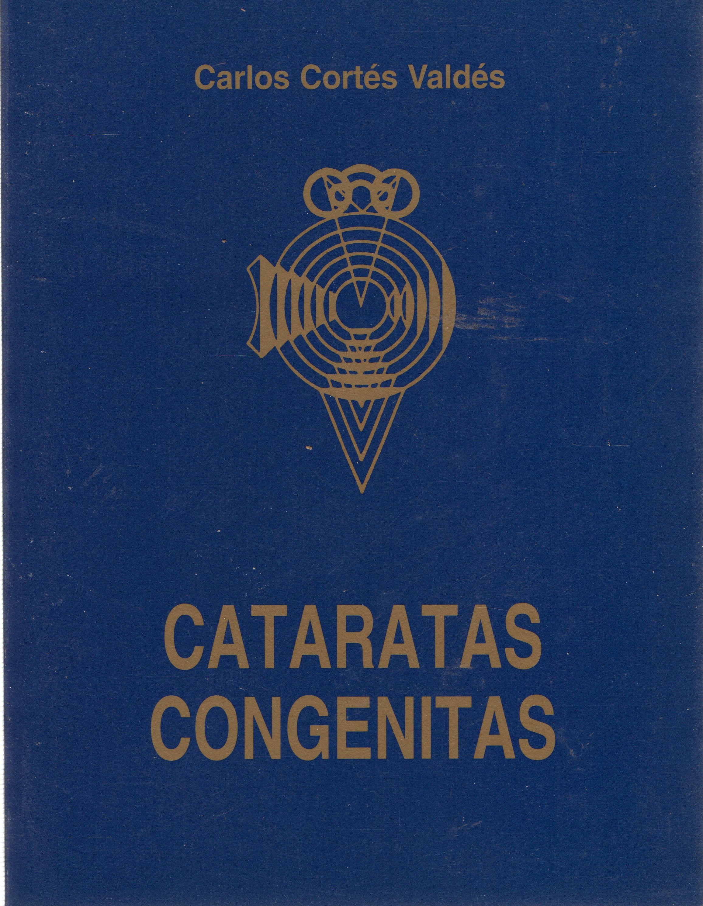 CATARATAS CONGENITAS