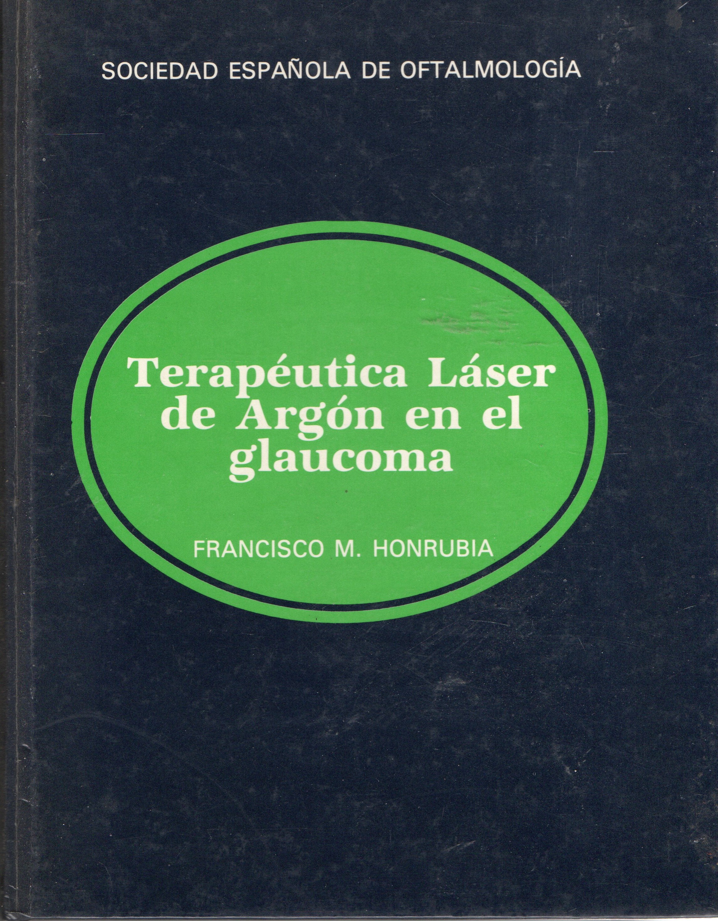 TERAPEUTICA LASER DE ARGON EN EL GLAUCOMA