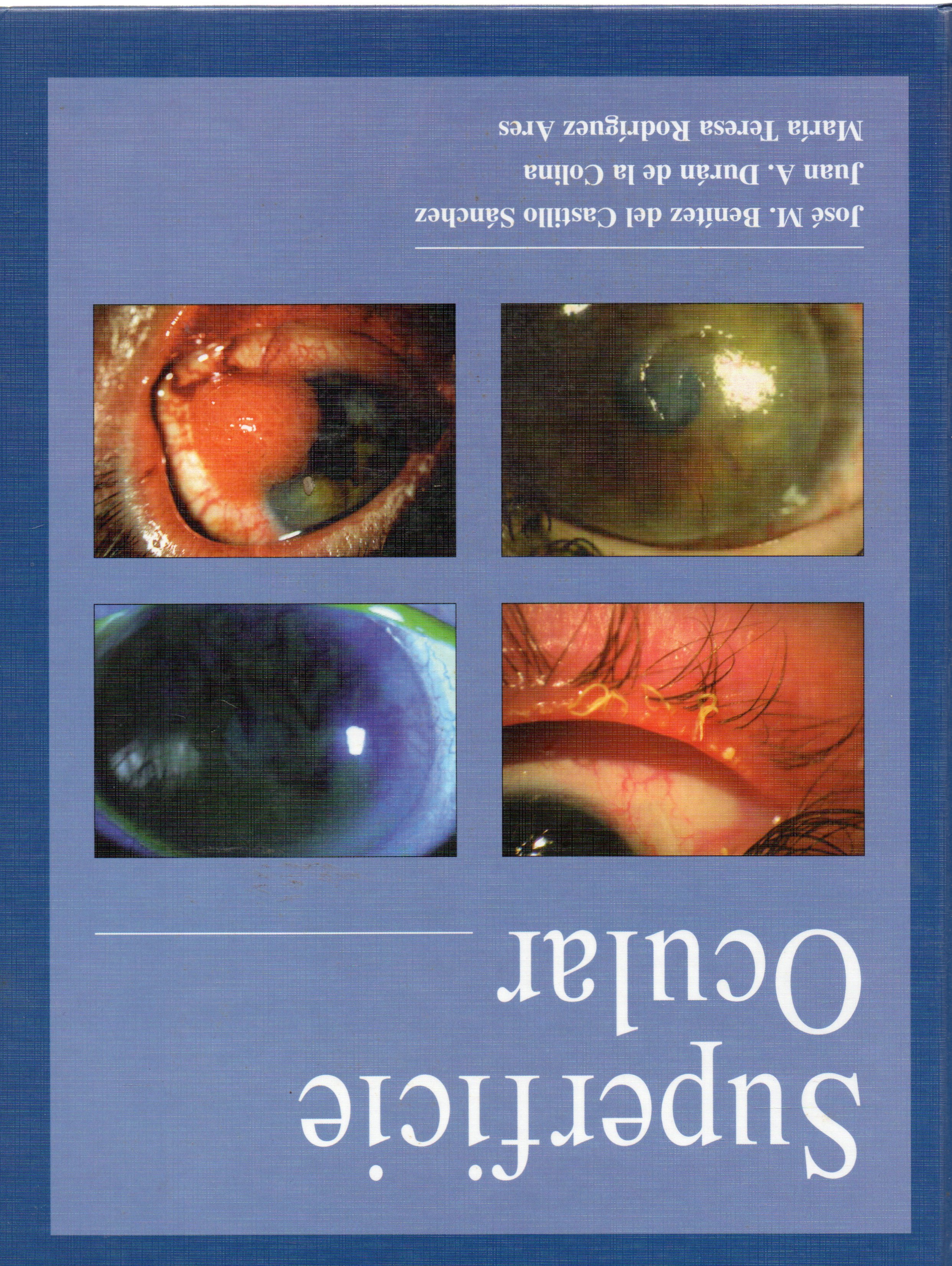 SUPERFICIE OCULAR