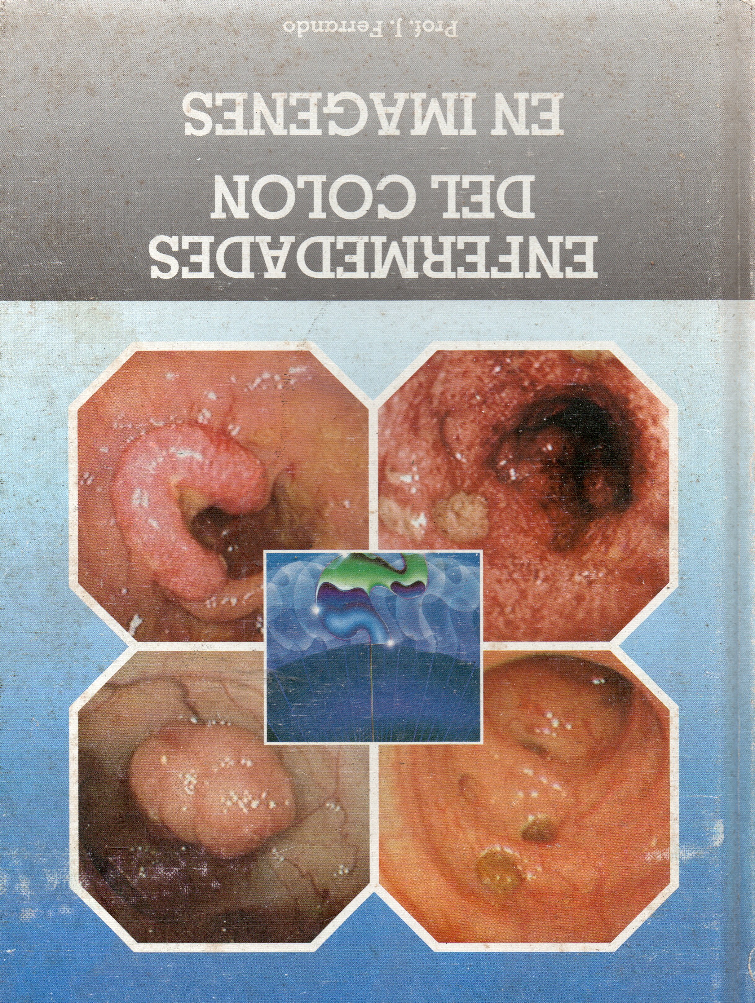 ENFERMEDADES DEL COLON EN IMÁGENES