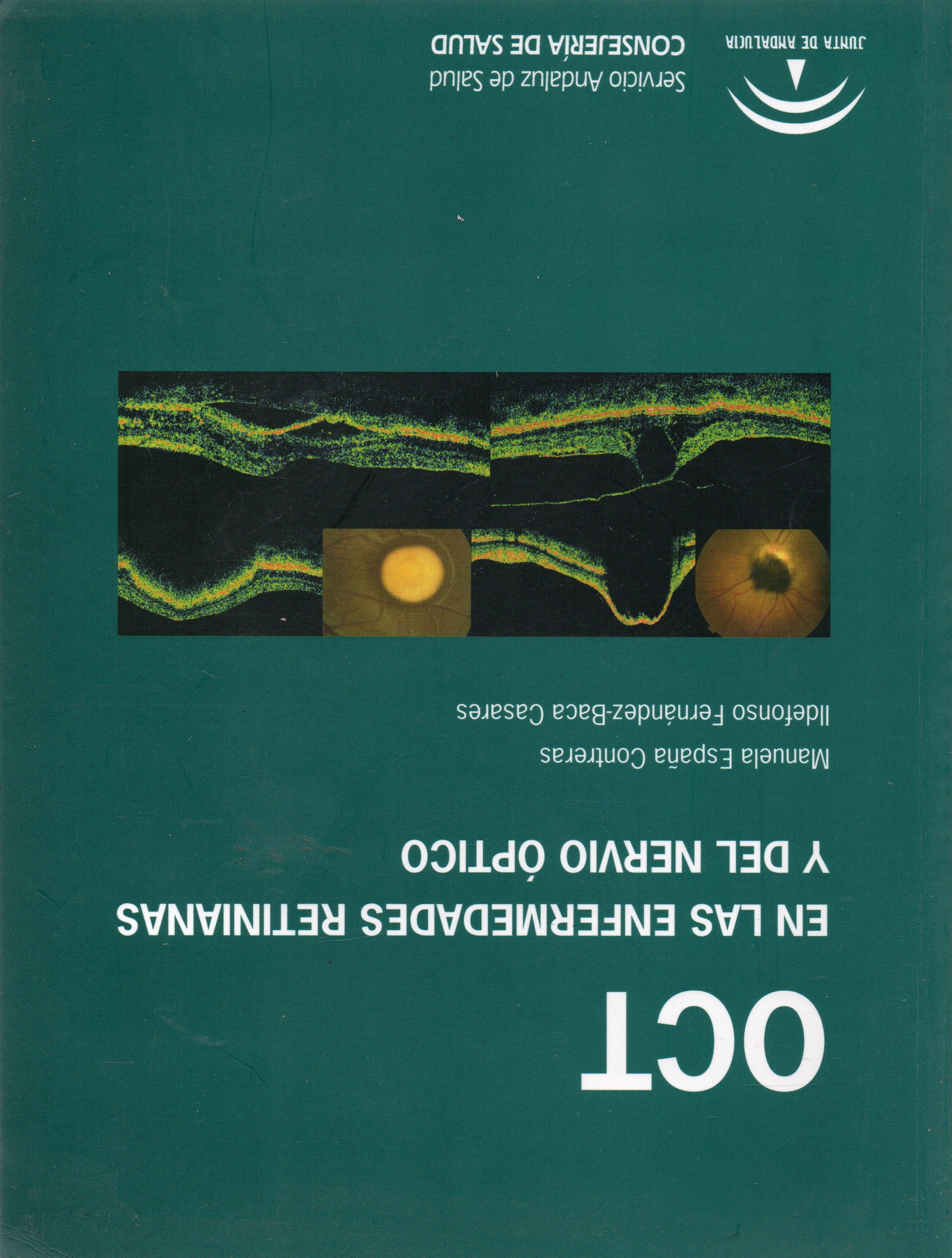 OCT EN LAS ENFERMEDADES RETINIANAS Y DEL NERVIO OPTICO