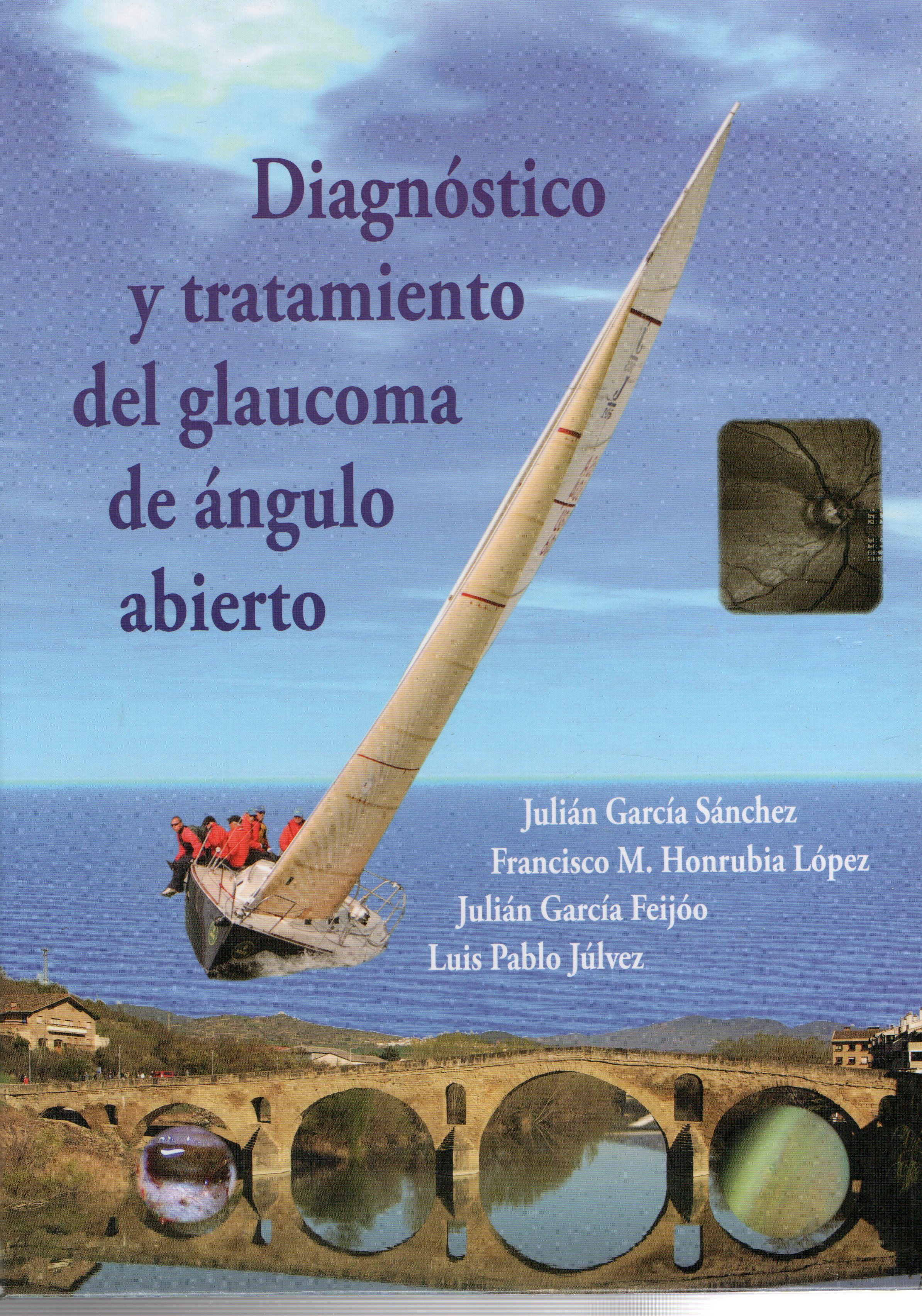 DIAGNOSTICO Y TRATAMIENTO DEL GLAUCOMA DE ANGULO ABIERTO