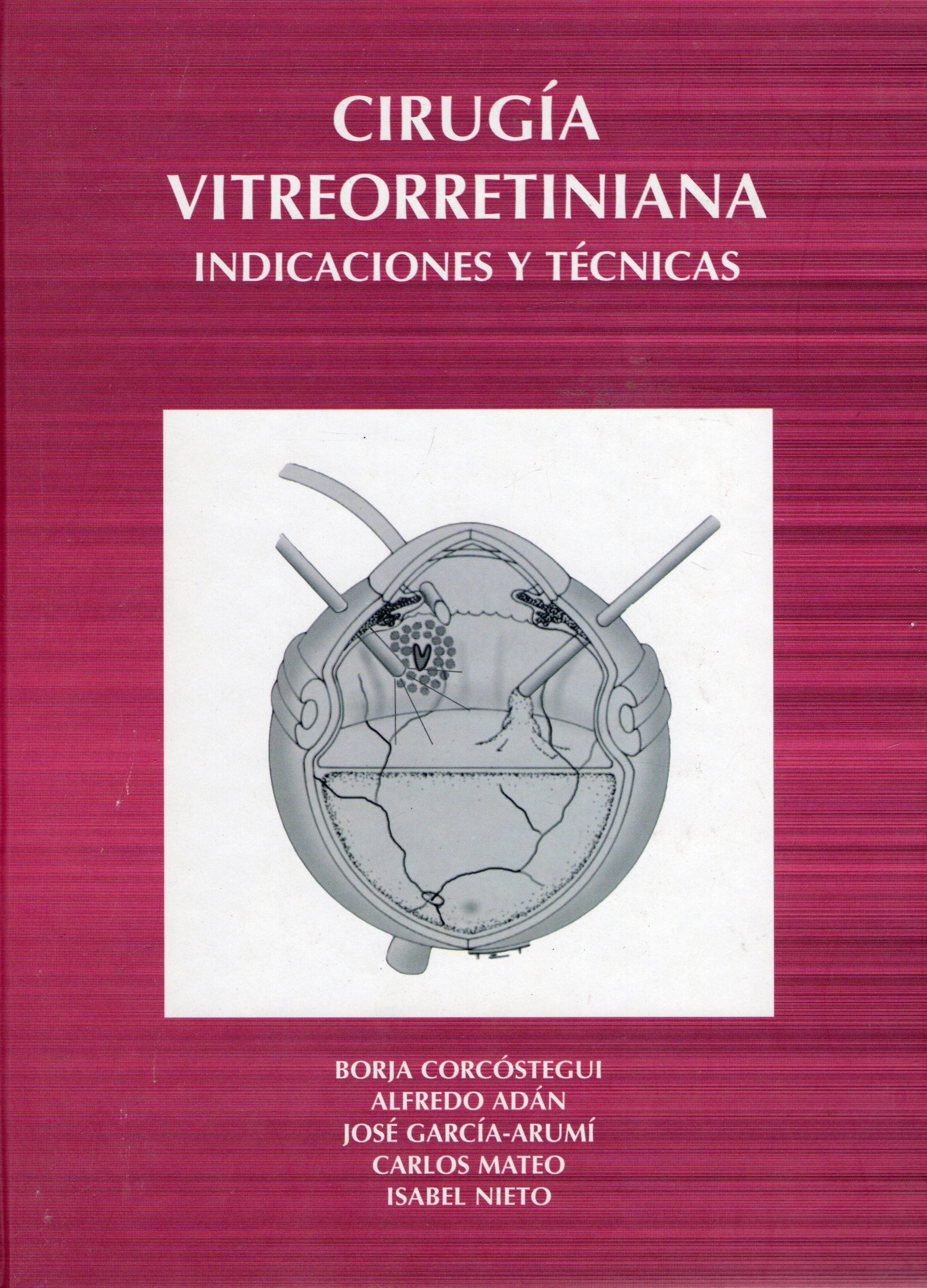 CIRUGIA VITREORRETINIANA INDICACIONES Y TECNICAS