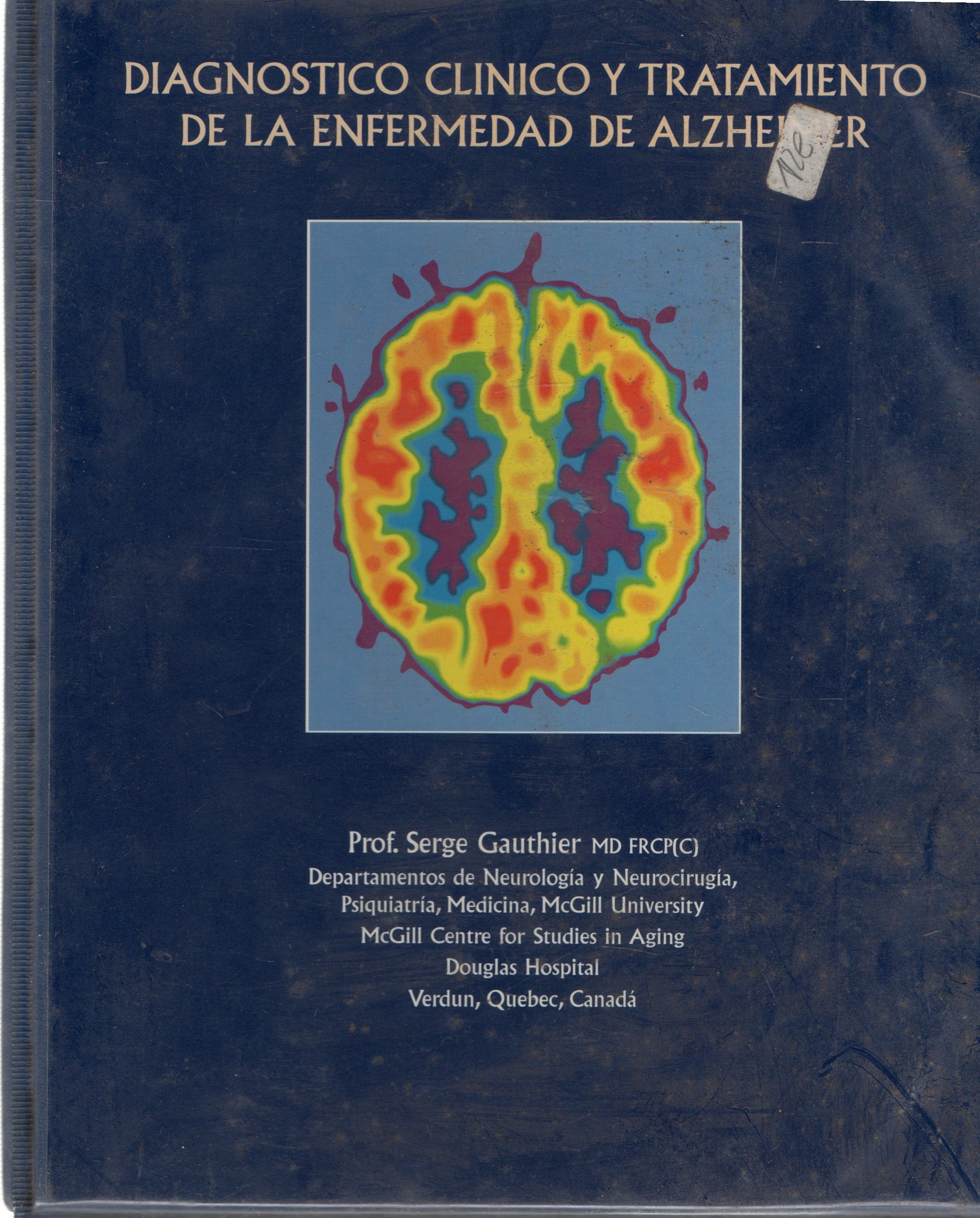 DIAGNOSTICO CLINICO Y TRATAMIENTO DE LA ENFERMEDAD DE ALZHEIMER