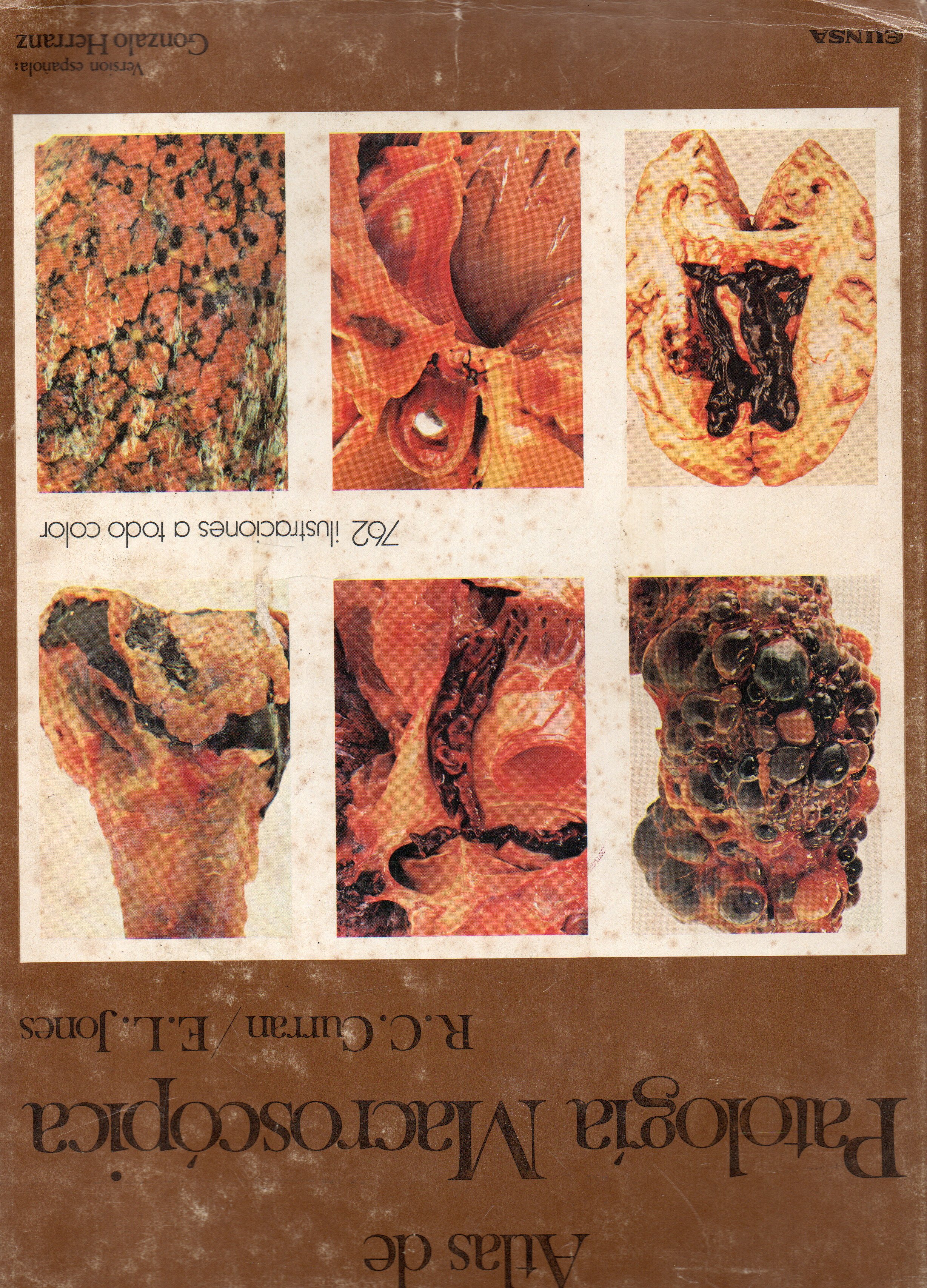 ATLAS DE PATOLOGIA MACROSCOPICA