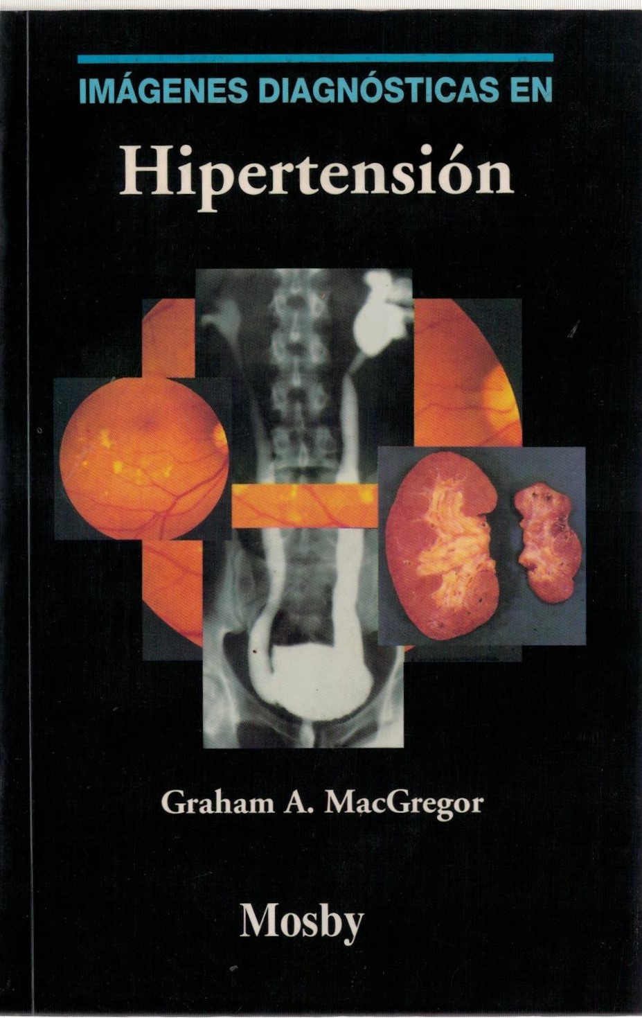 IMÁGENES DIAGNOSTICAS EN HIPERTENSION