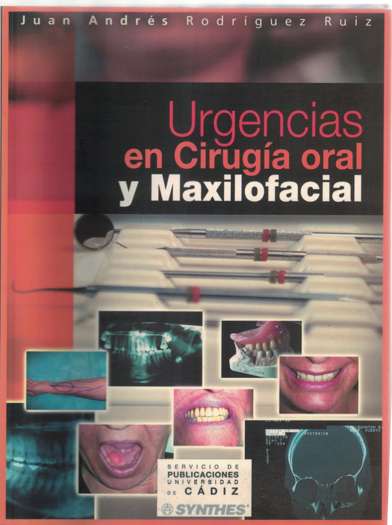 URGENCIAS EN CIRUGIA ORAL Y MAXILOFACIAL