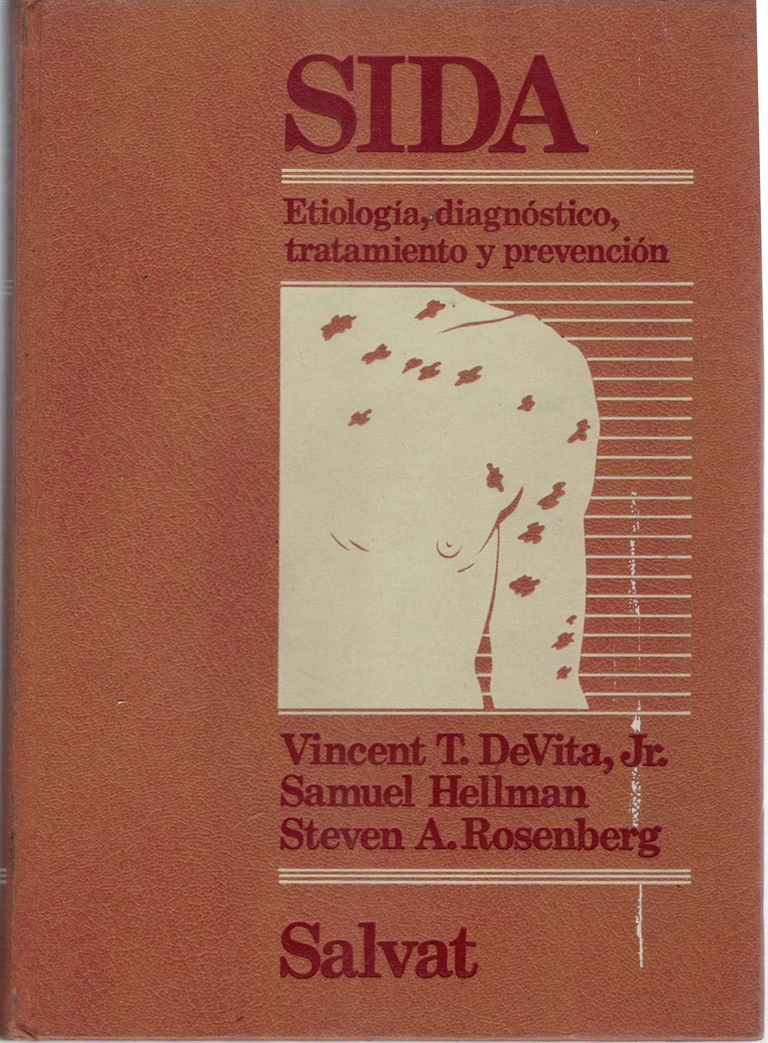 SIDA ETIOLOGIA, DIAGNOSTICO, TRATAMIENTO Y PREVENCION