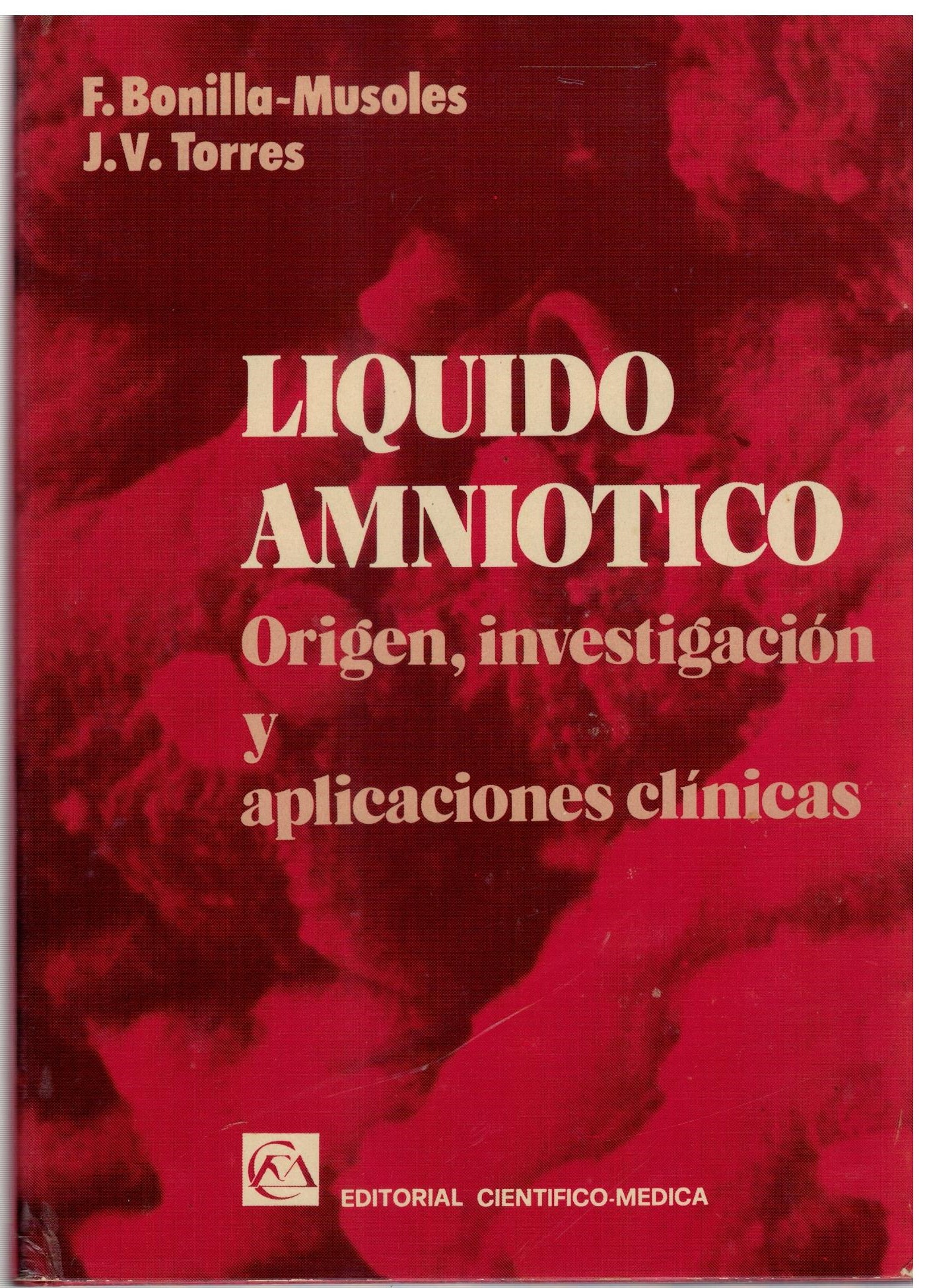 LIQUIDO AMNIOTICO ORIGEN, INVESTIGACION Y APLICACIONES CLINICAS