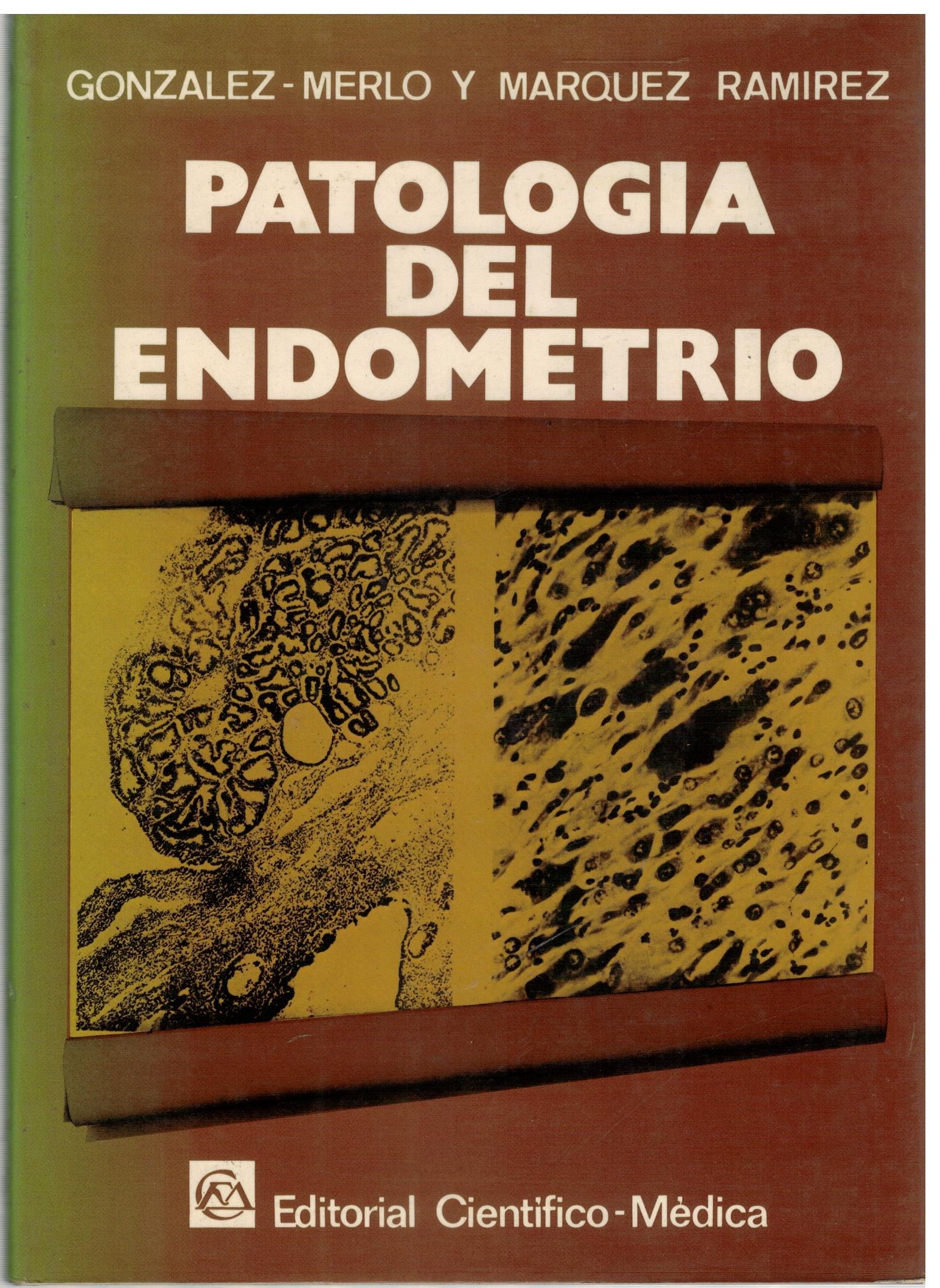 PATOLOGIA DEL ENDOMETRIO