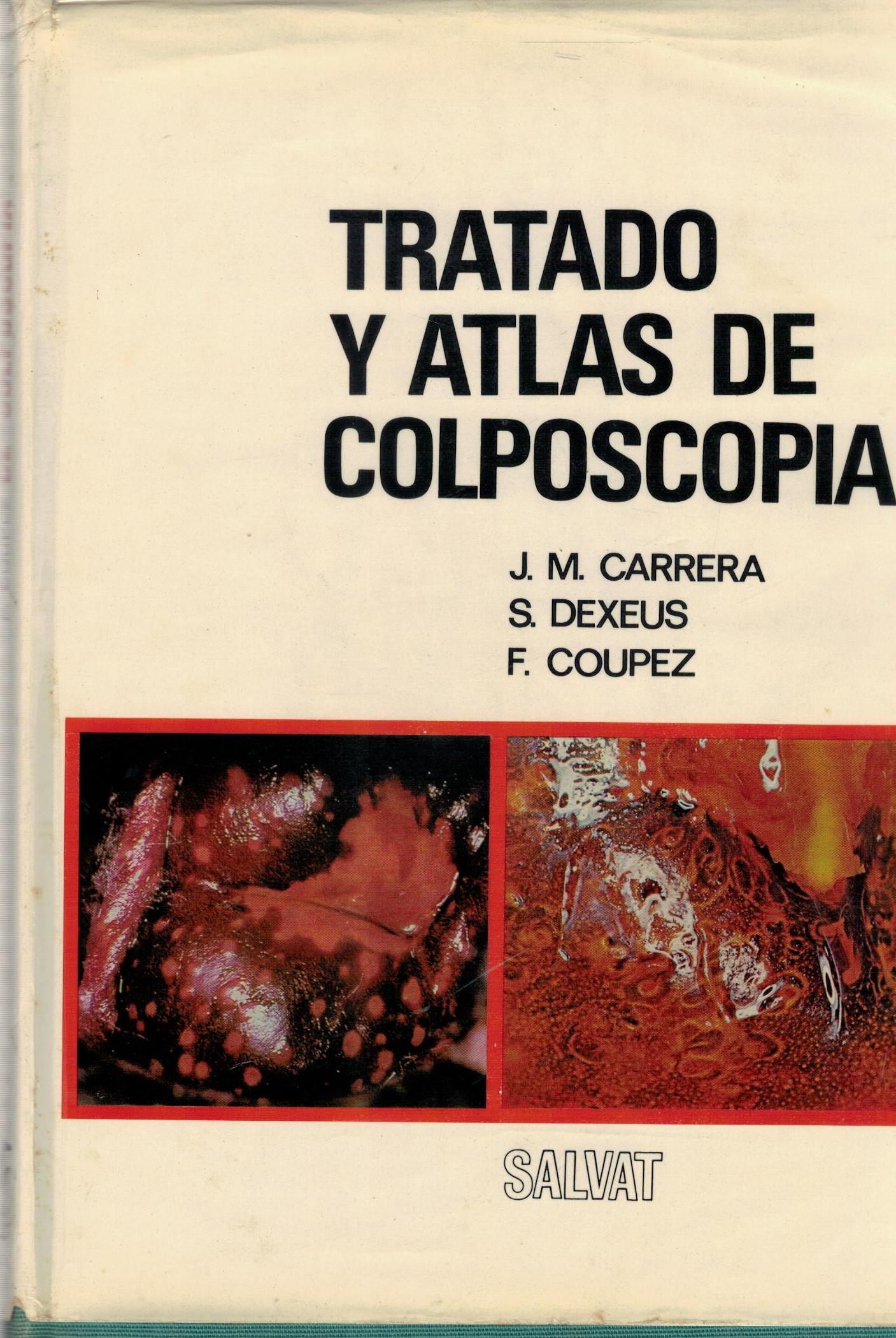 TRATADO Y ATLAS DE COLPOSCOPIA