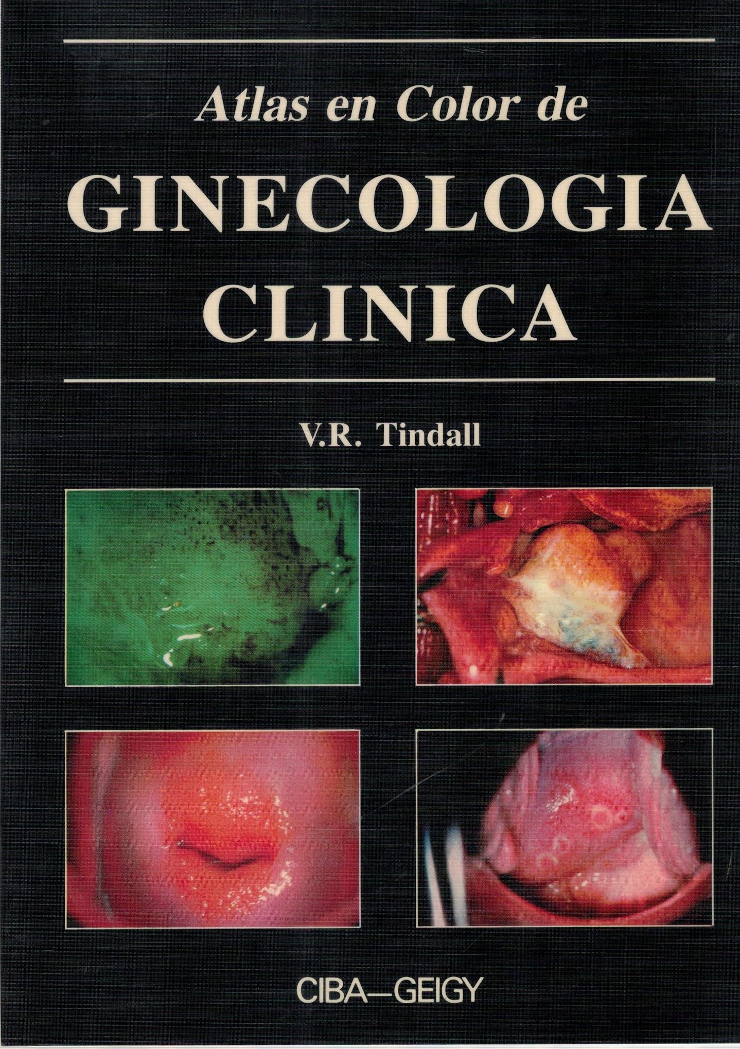 ATLAS EN COLOR DE GINECOLOGIA CLINICA