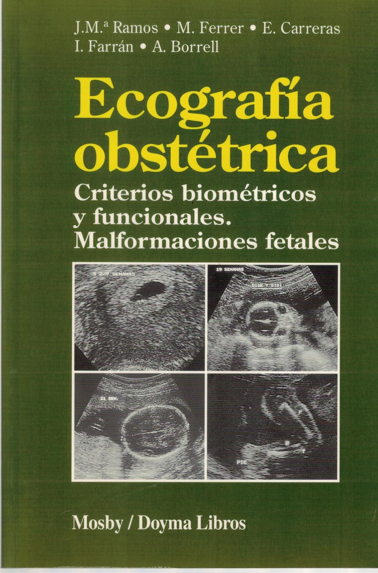 ECOGRAFIA OBSTETRICA