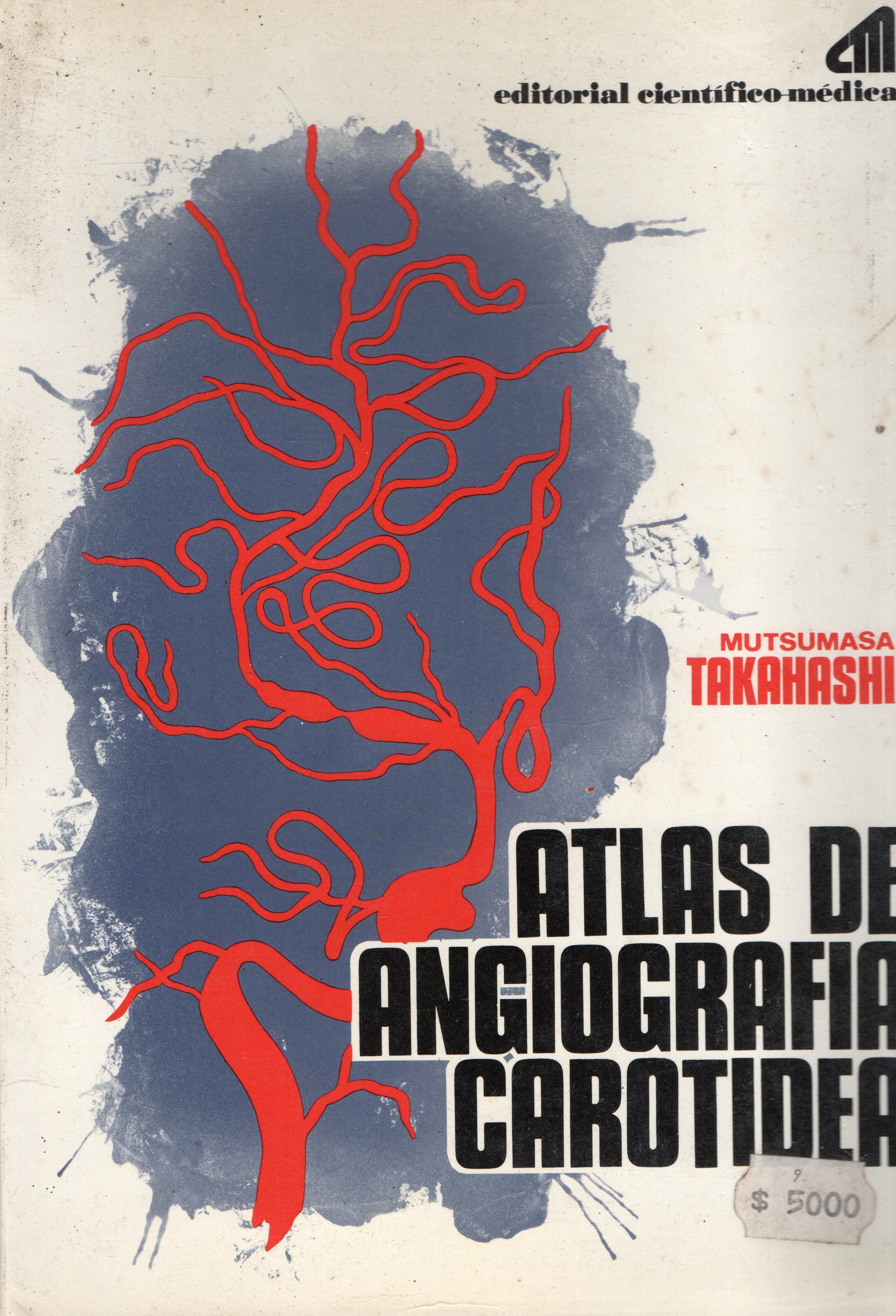 ATLAS DE ANGIOGRAFIA CAROTIDEA.