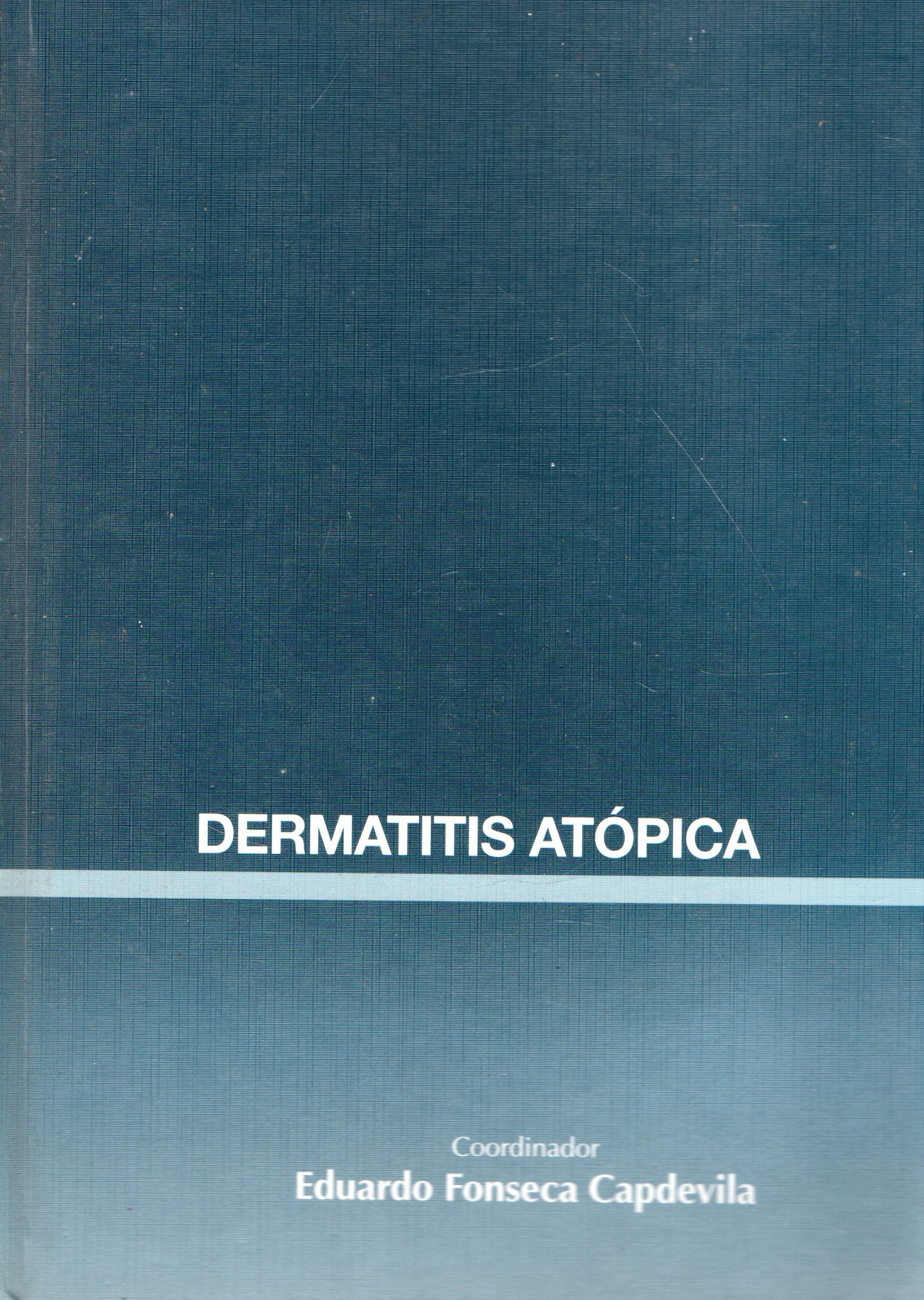 DERMATITIS ATOPICA.