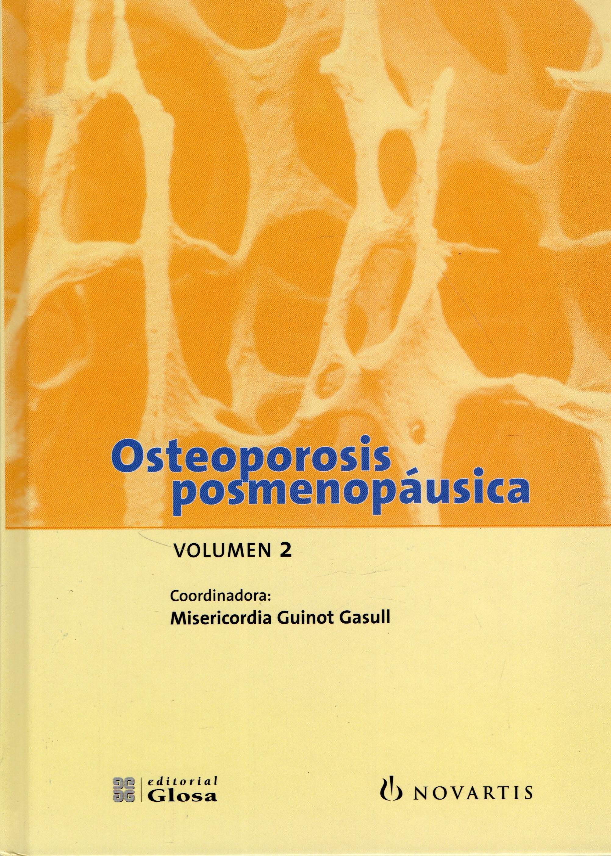 OSTEOPOROSIS POSMENOPAUSICA VOL 2.