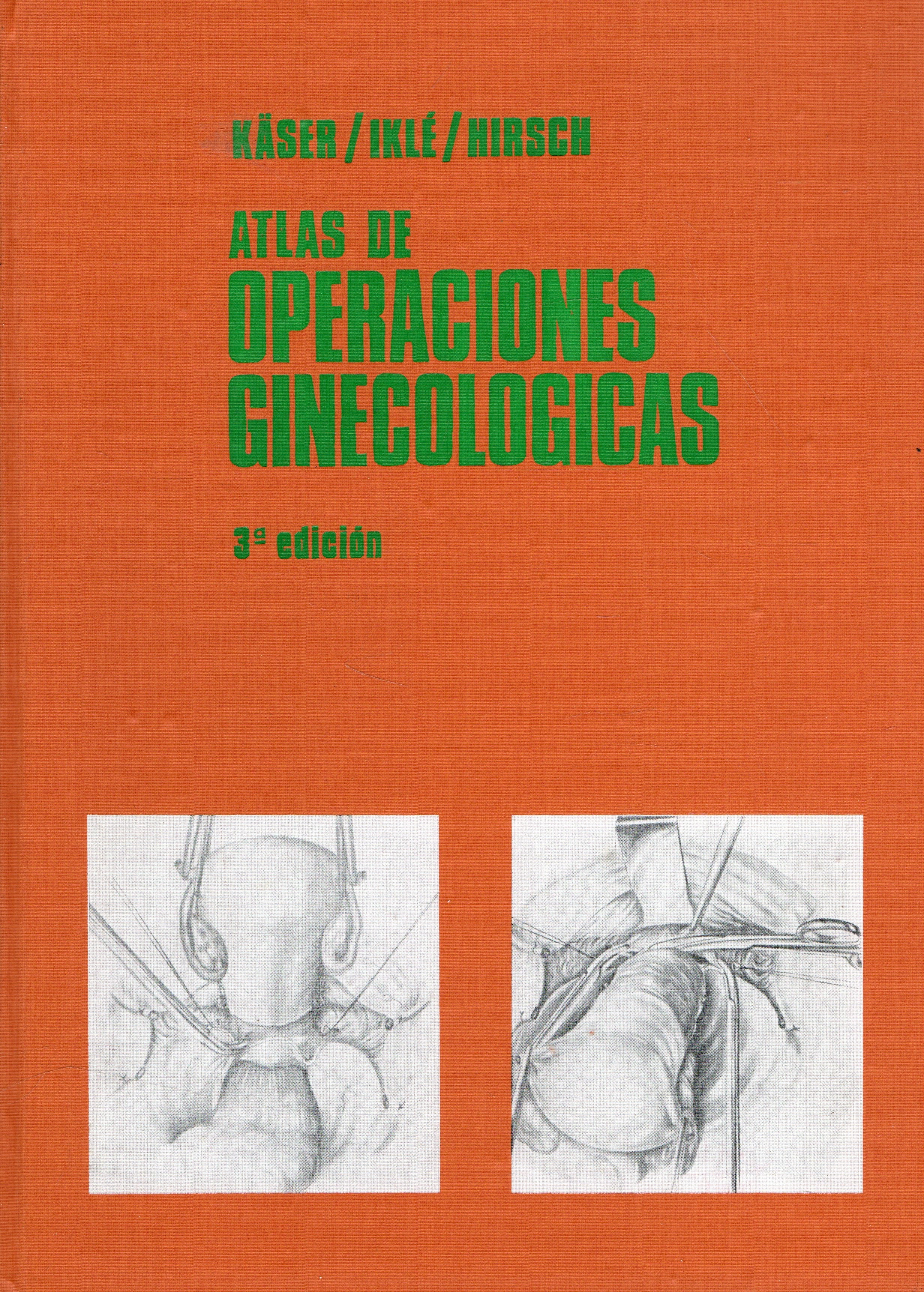 ATLAS DE OPERACIONES GINECOLOGICAS