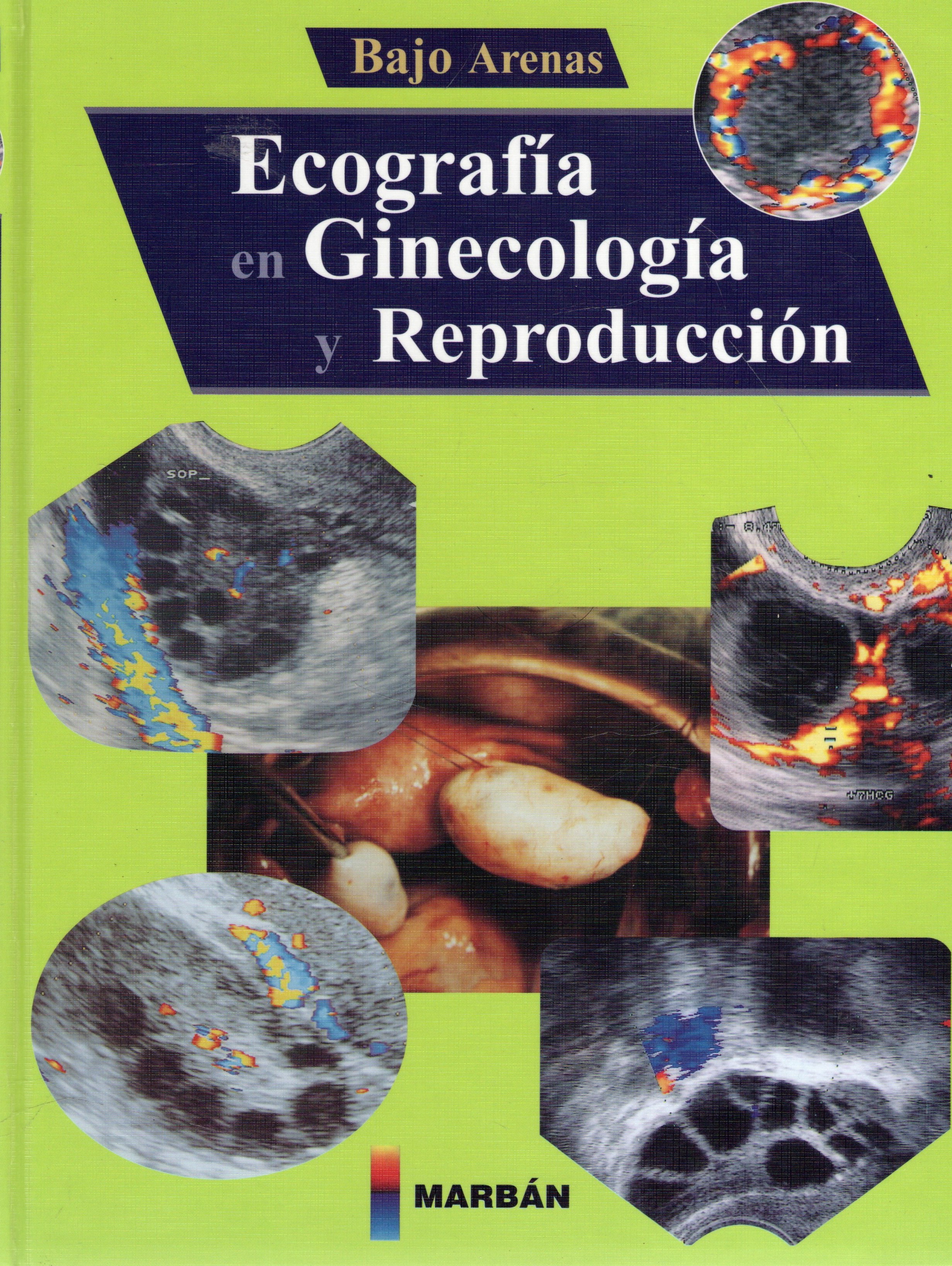 ECOGRAFIA EN GINECOLOGIA Y REPRODUCCION
