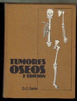 TUMORES ÓSEOS
