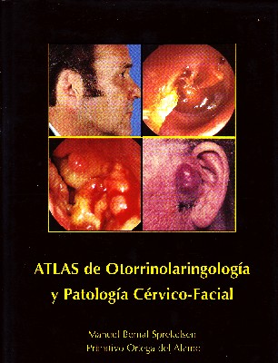 ATLAS DE OTORRINOLARINGOLOGIA Y PATOLOGIA CERVICO-FACIAL