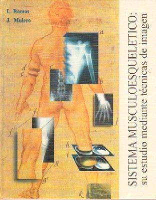 SISTEMA MUSCULOESQUELETICO: SU ESTUDIO MEDITANTE TECNICAS DE IMAGEN