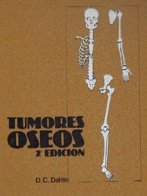 TUMORES OSEOS