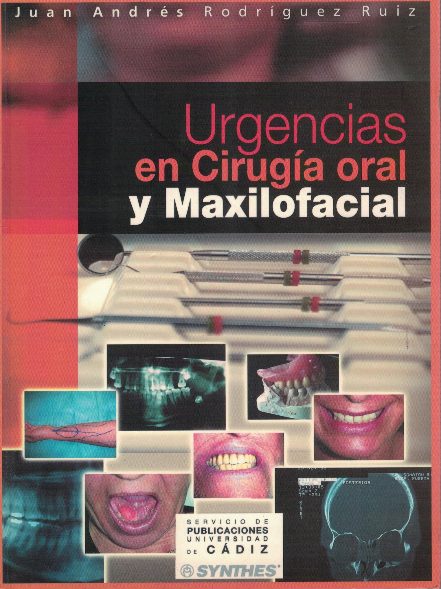 URGENCIAS EN CIRUGÍA ORAL Y MAXILOFACIAL