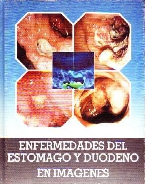 ENFERMEDADES DEL ESTOMAGO Y DUODENO EN IMÁGENES