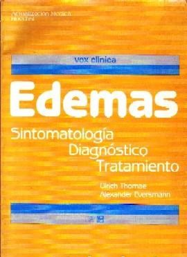 EDEMAS SINTOMATOLOGÍA DIAGNÓSTICO TRATAMIENTO