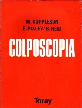 COLPOSCOPIA