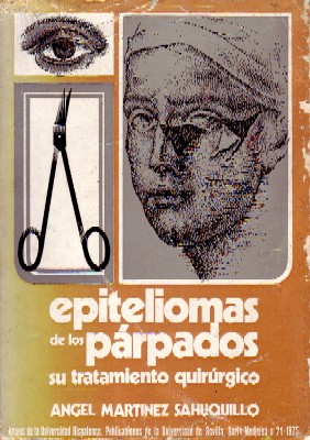 EPITELIOMAS DE LOS PARPADOS