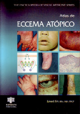 ATLAS DE ECCEMA ATÓPICO