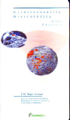 ULTRASONOGRAFIA GINECOLOGICA