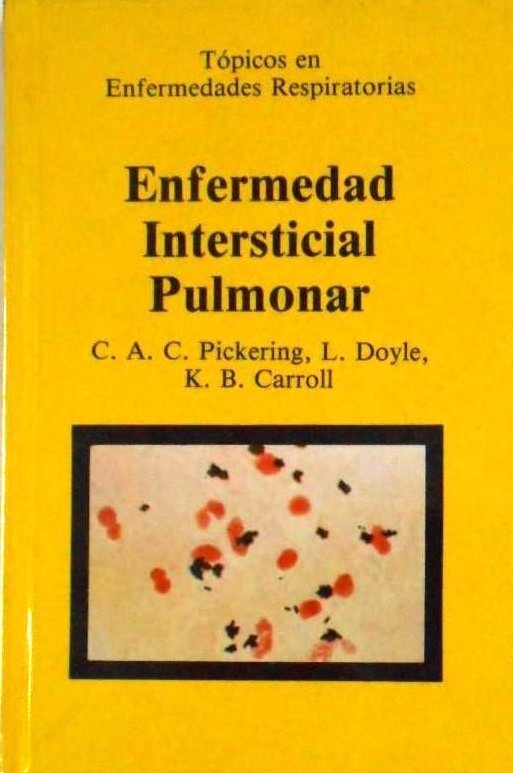 ENFERMEDADES INTERSTICIAL PULMONAR