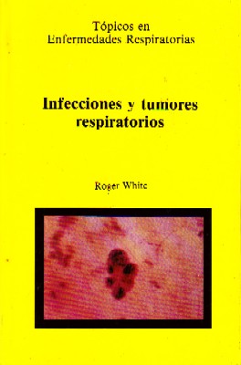 INFECCIONES Y TUMORES RESPIRATORIOS