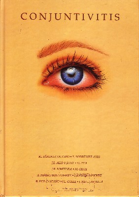 CONJUNTIVITIS