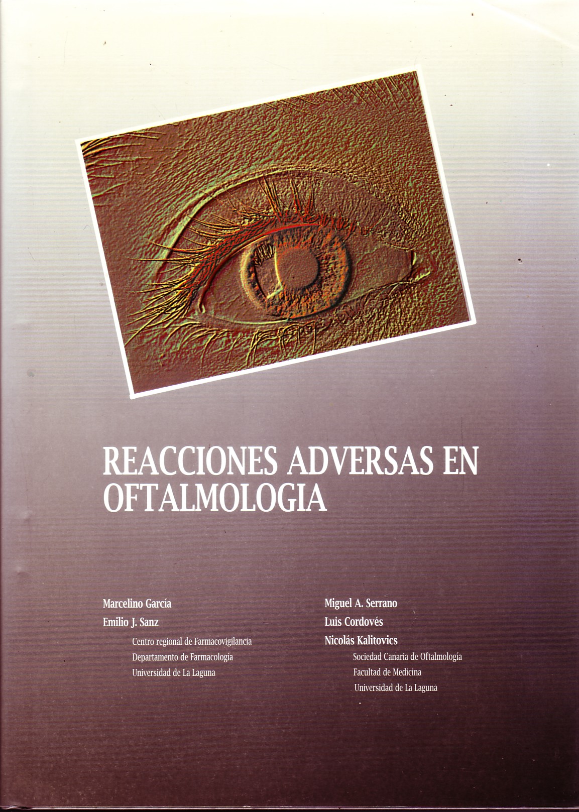 REACCIONES ADVERSAS EN OFTALMOLOGIA