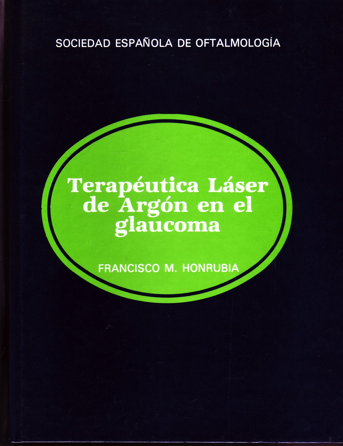 TERAPEUTICA LASER DE ARGON EN EL GLAUCOMA