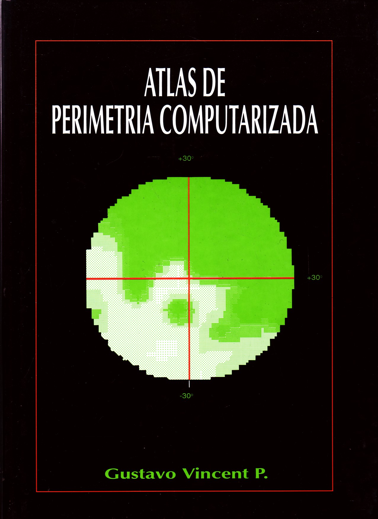 ATLAS DE PERIMETRIA COMPUTARIZADA