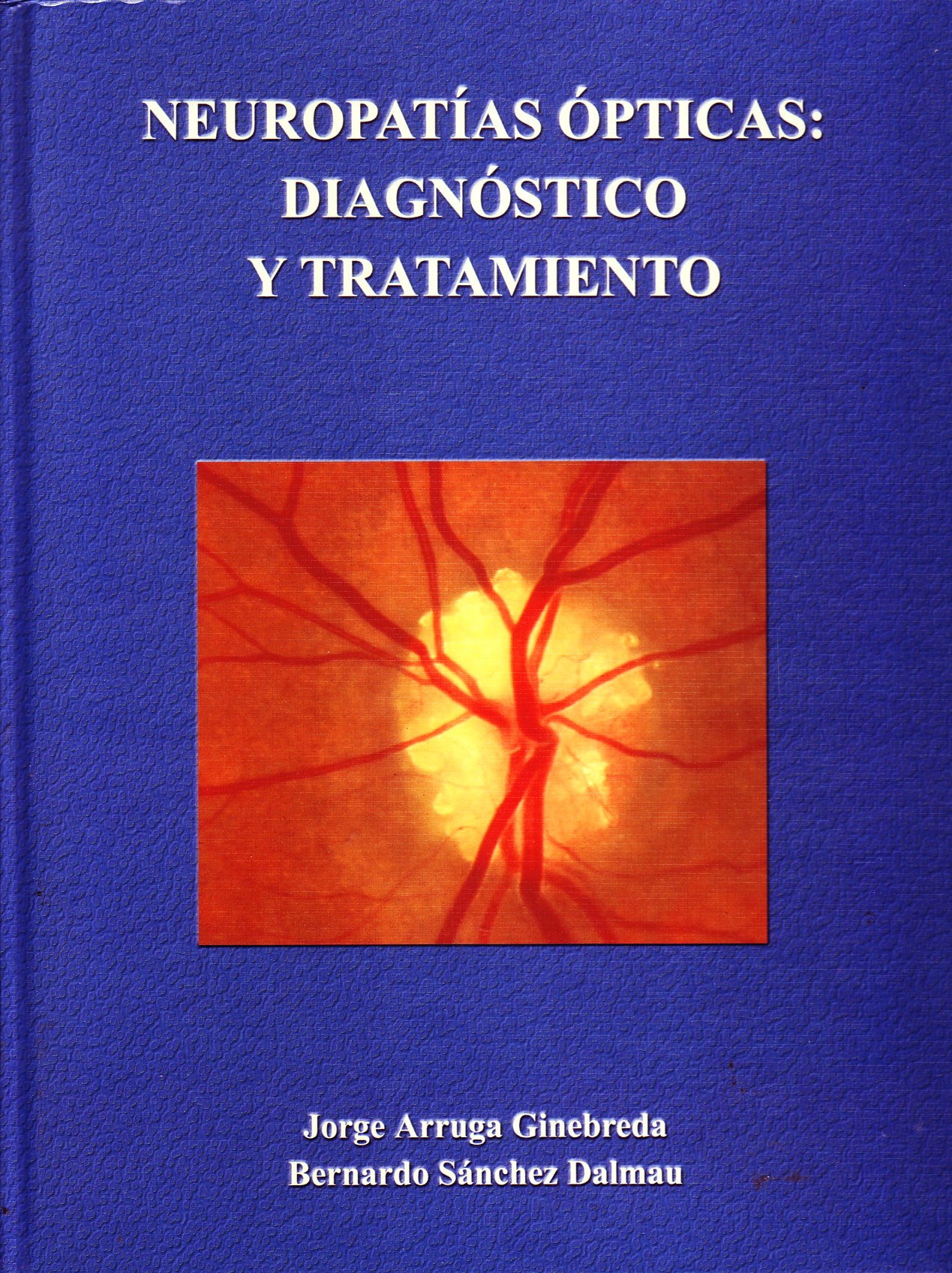 NEUROPATIAS OPTICAS: DIAGNOSTICO Y TRATAMIENTO.