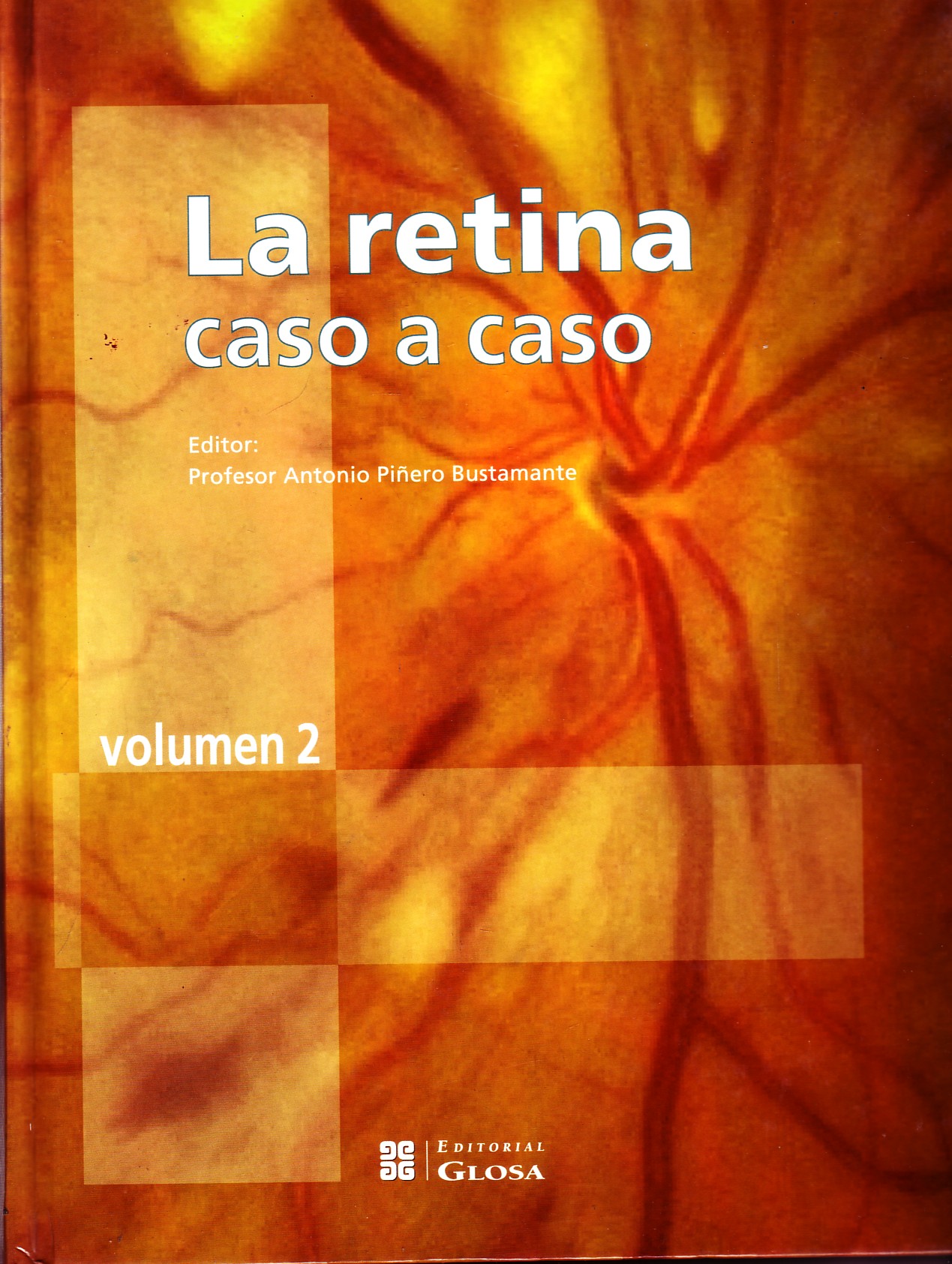 LA RETINA CASO A CASO. VOLUMEN 2