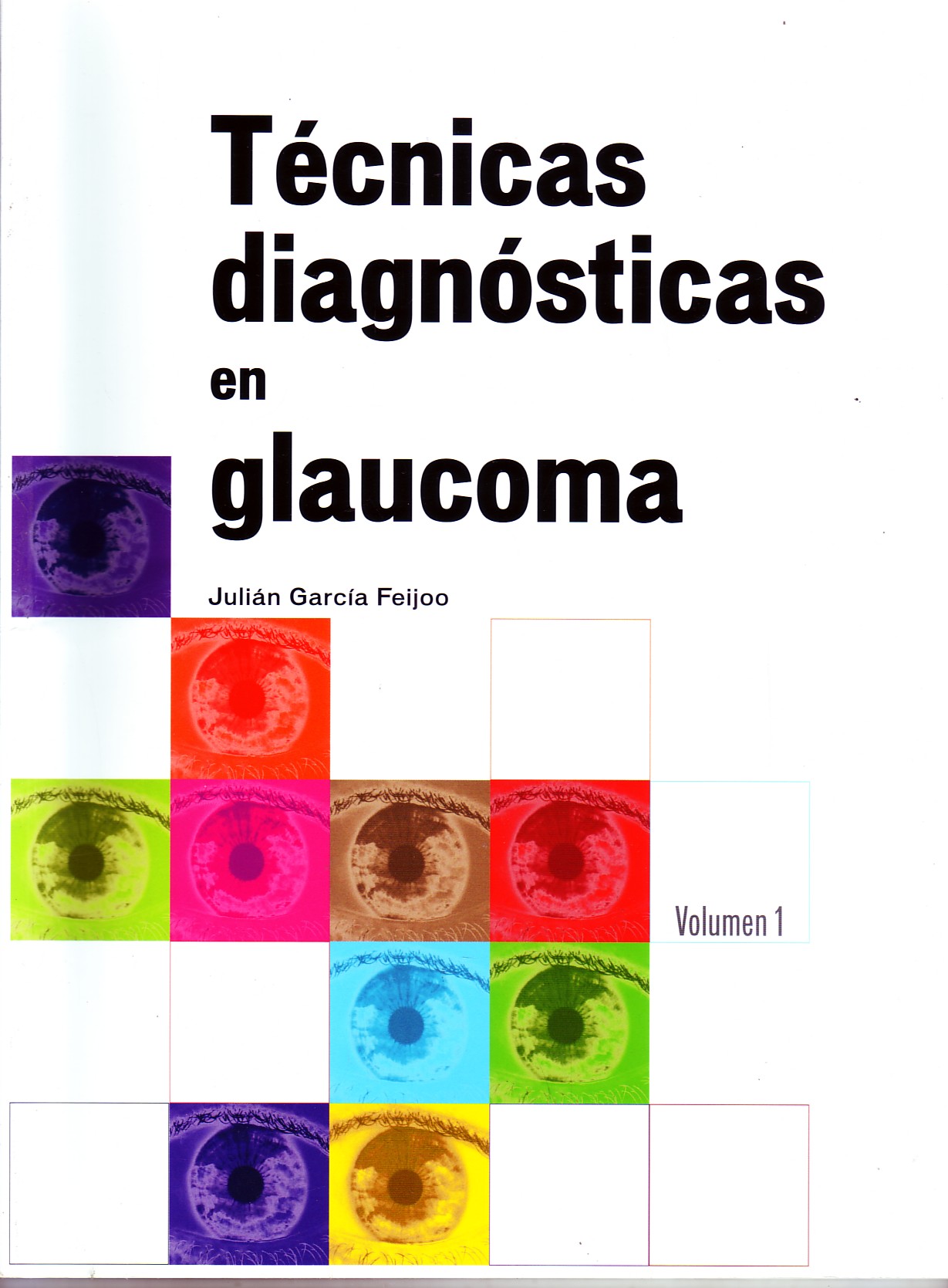 TECNICAS DIAGNOSTICAS EN GLAUCOMA. VOLUMEN 1.